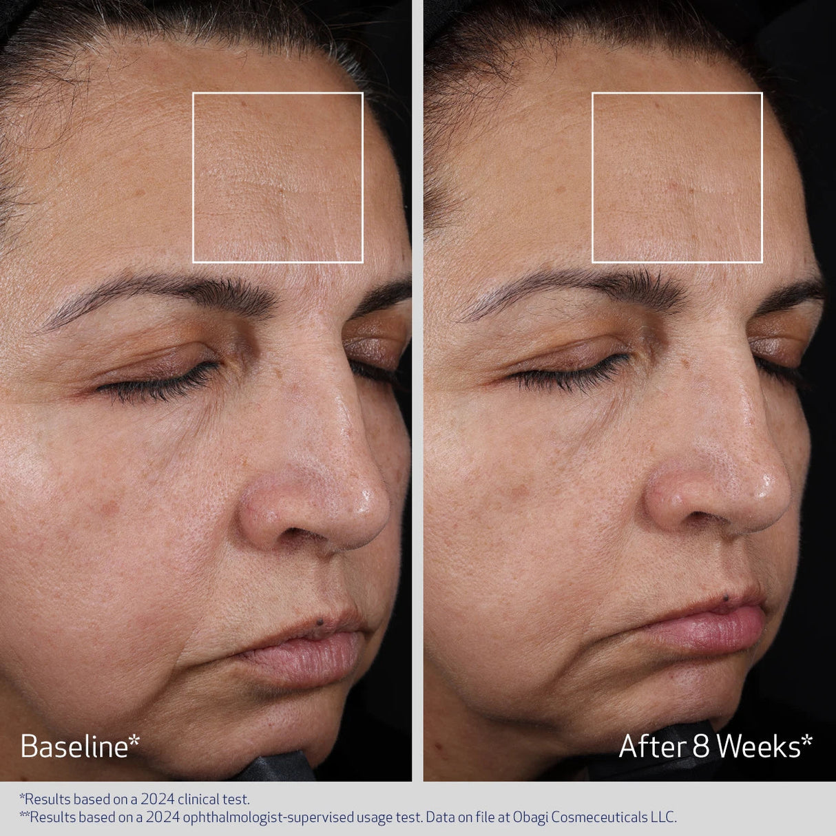 ELASTIderm Advanced Filler Concentrate 20ml
