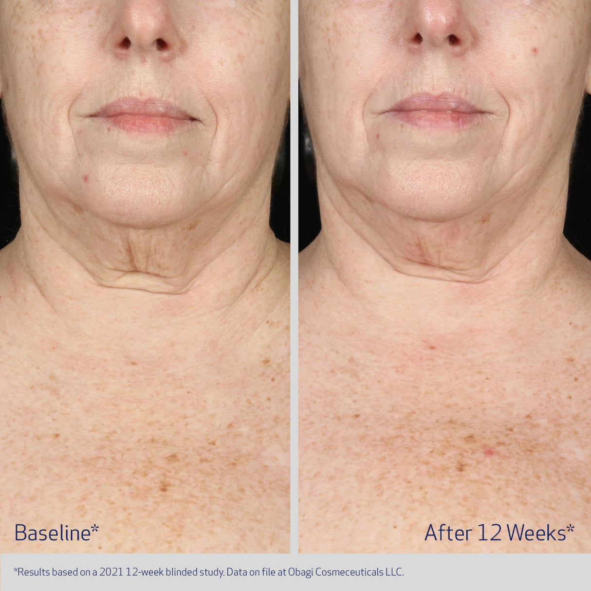 ELASTIderm Neck & Décolleté Concentrate 60ml