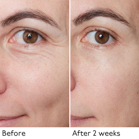 Hyaluronic Global Serum 30ml