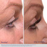 Nu-Cil Eyelash Enhancing Serum 3ml