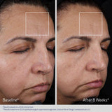 ELASTIderm Advanced Filler Concentrate 20ml