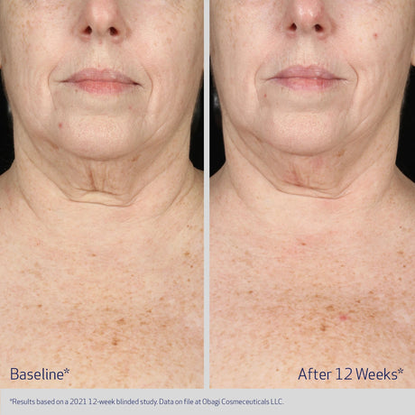 ELASTIderm Neck & Décolleté Concentrate 60ml