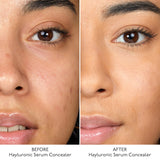 Hyaluronic Serum Concealer 5,2ml