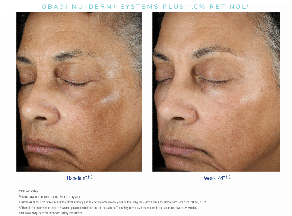 Obagi Complete Skin Transformation Kit