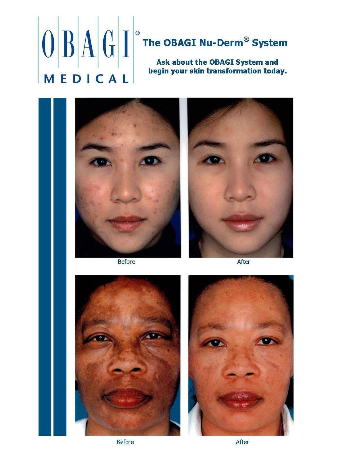 Obagi Complete Skin Transformation Kit