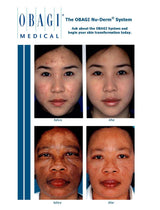 Obagi Complete Skin Transformation Kit