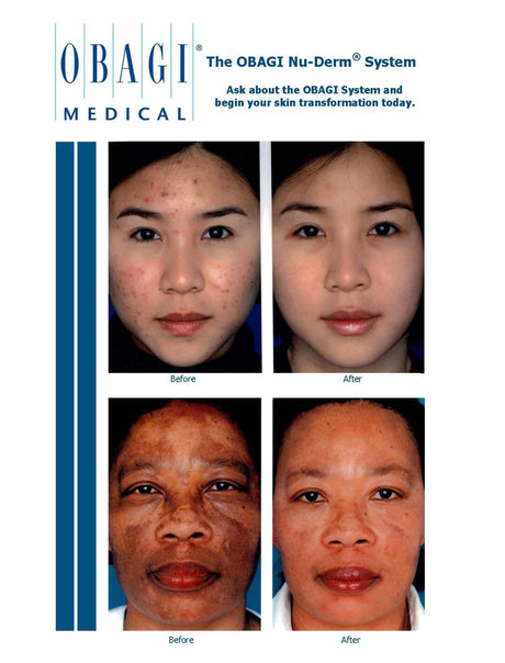 Obagi Complete Skin Transformation Kit