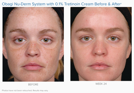 Obagi Complete Skin Transformation Kit