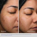 Retinol + PHA Refining Night Cream 50ml